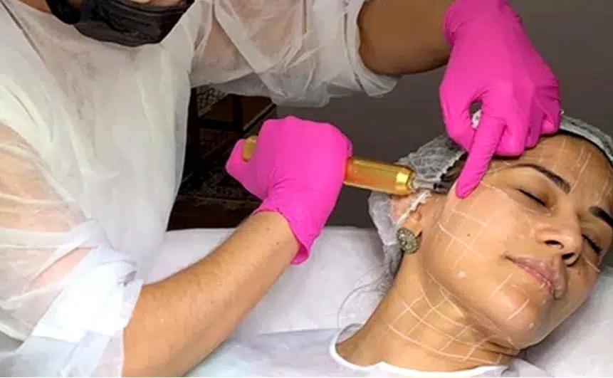 Formação Harmonização Facial & Corporal
