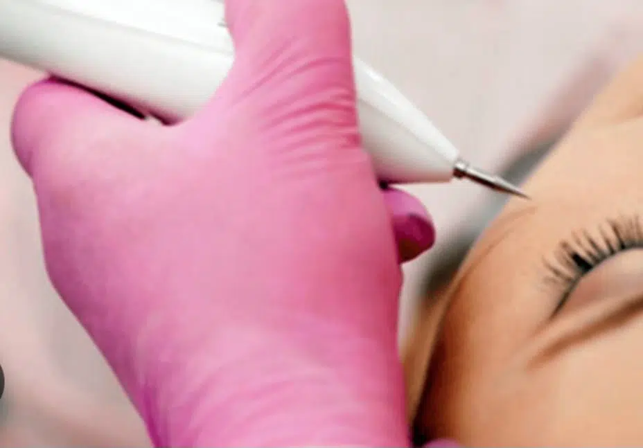 Formação Jacto de Plasma